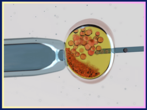 ivf treatment in georgia