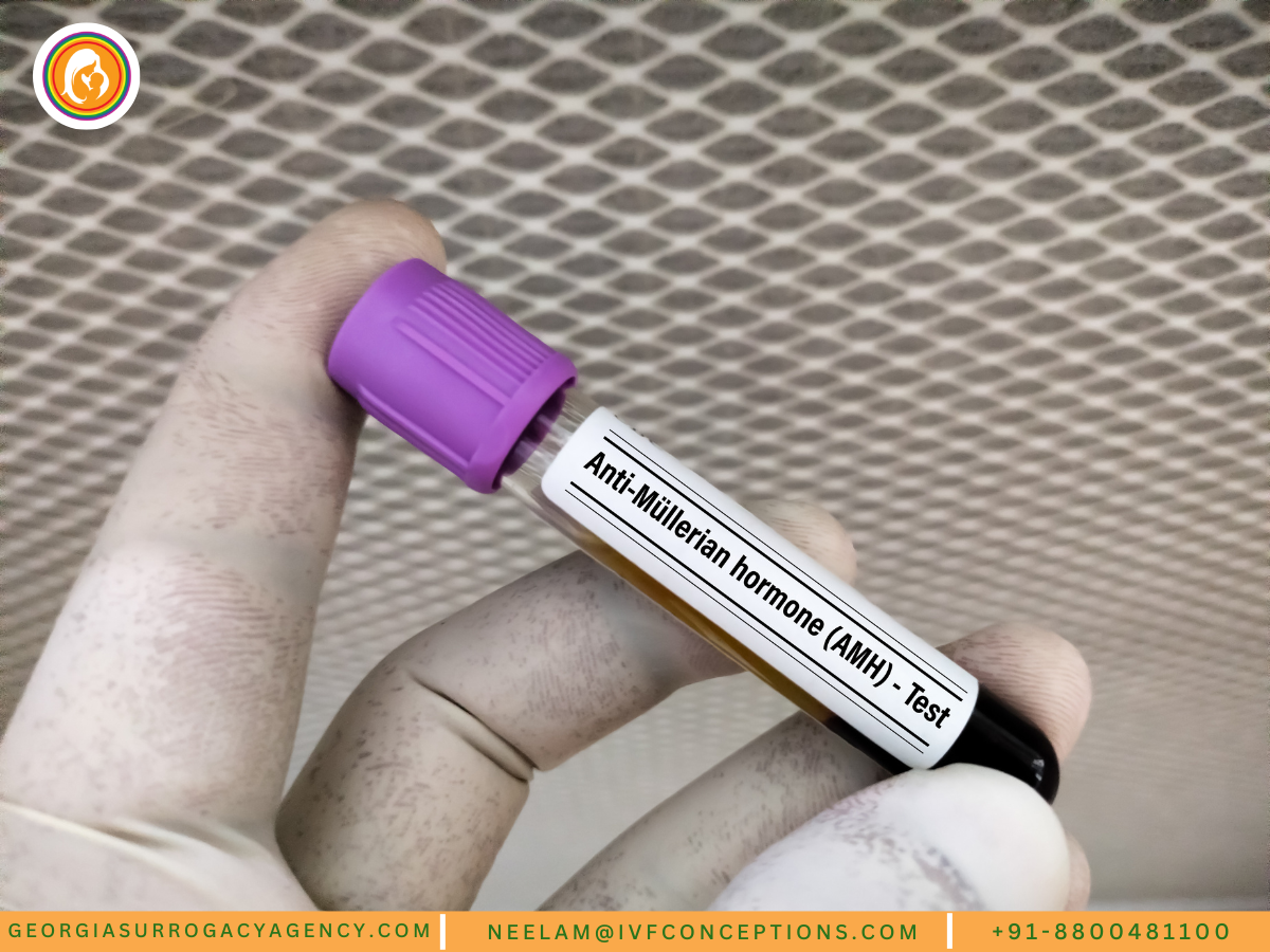 Anti-Müllerian Hormone (AMH