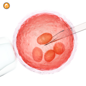 embryo transfer