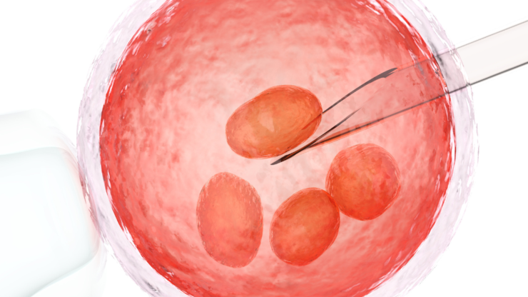embryo transfer
